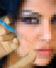 Plastic Surgery Statistics